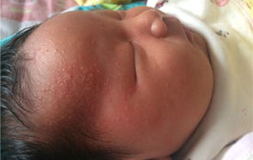 ʪ����ʲô ʪ������������ͼƬ